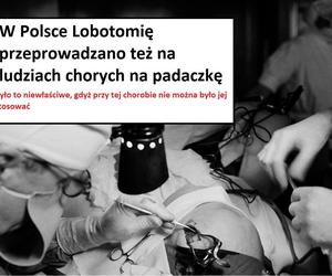 W tych przypadkach stosowano lobotomię