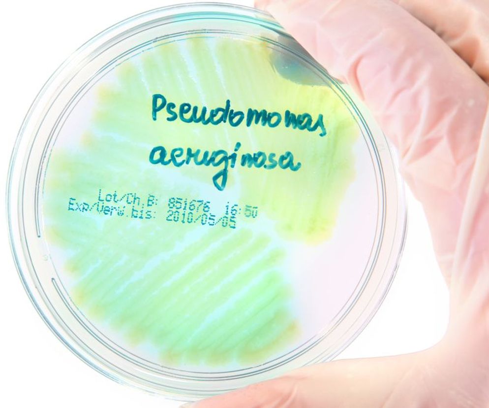 Pałeczka ropy błękitnej  to jedna z najniebezpieczniejszych bakterii