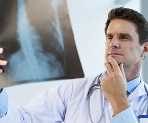 Choroba Pageta kości – przyczyny, objawy i leczenie