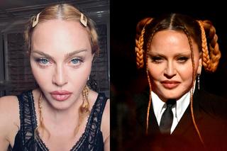 Madonna ma jeszcze nowszą twarz! 65-letnia gwiazda wygląda jak 20-latka?