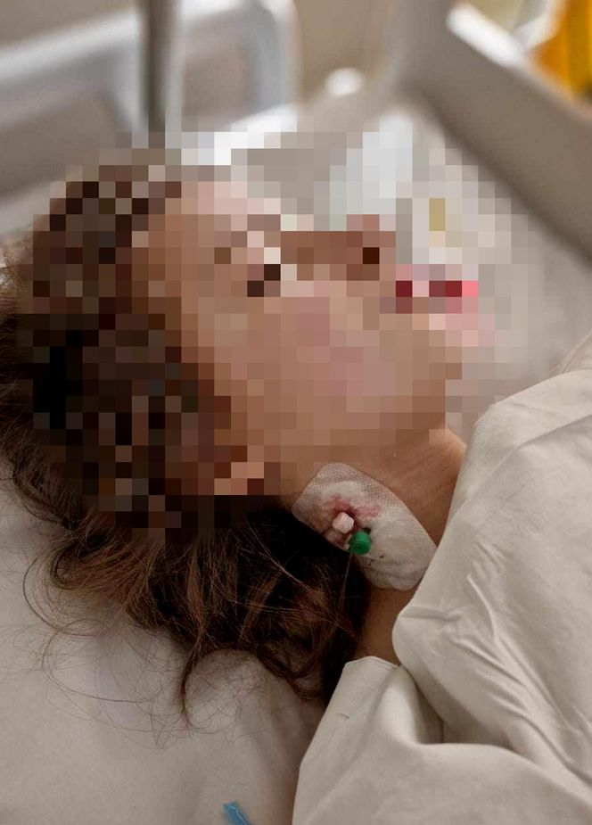 Skandalicznie niski wyrok dla sprawcy potrącenia nastolatki na pasach