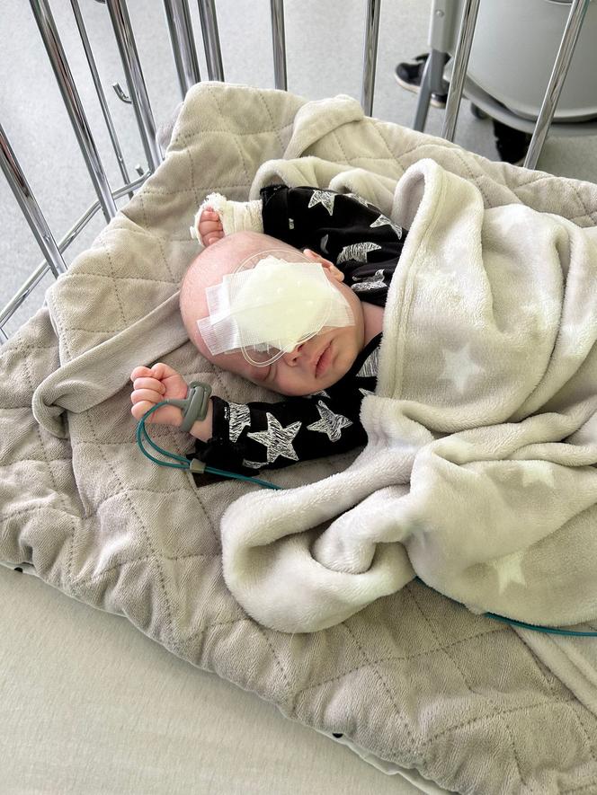 Apel o pomoc dla bliźniaków