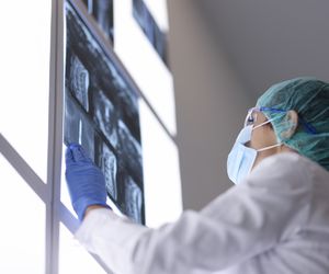 Złamanie kręgosłupa – czy zawsze prowadzi do kalectwa?