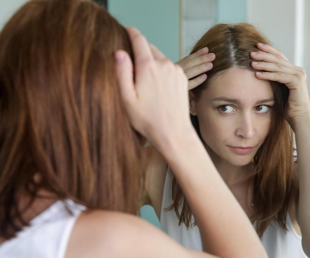 Łupież czerwony - przyczyny, objawy, leczenie