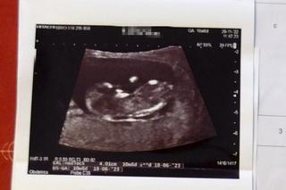 Mogli stracić dziecko przez błąd lekarki?