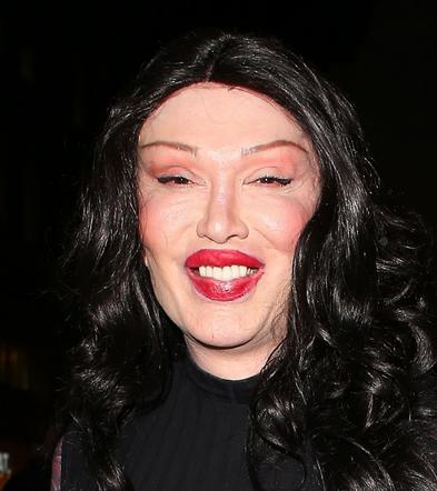 Pete Burns