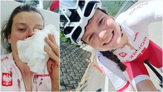 Wypadek polskiej olimpijki z Tokio! Pocięta cała twarz, przeszła operację!