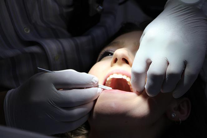 Leczenie zębów w Lublinie: Studenci zrobią to prawie za darmo!