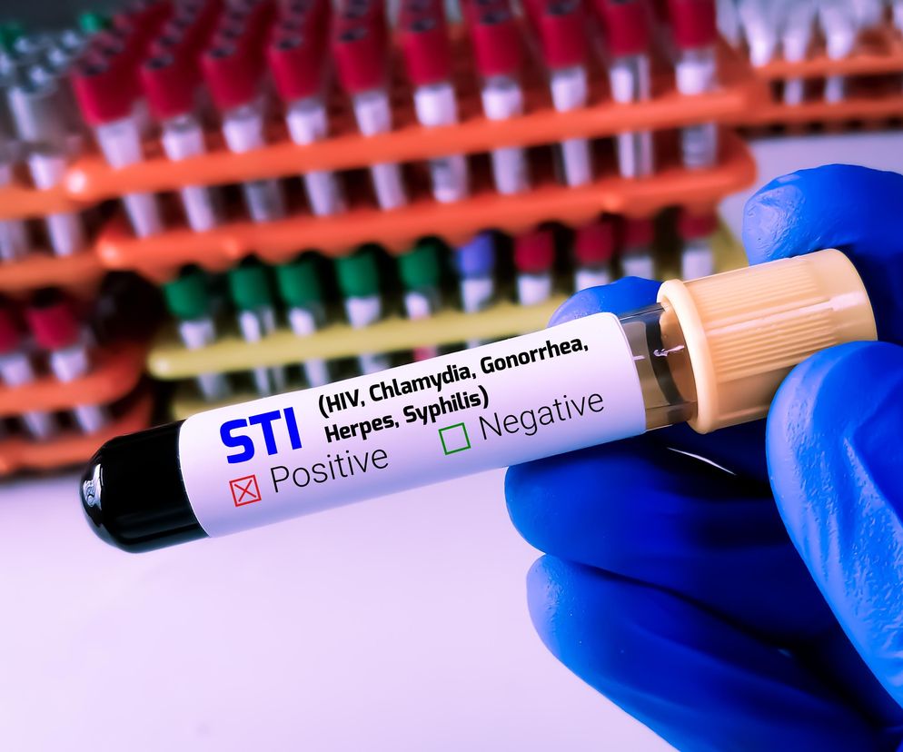 Liczba przypadków kiły wzrosła siedmiokrotnie. Zagrożona zwłaszcza jedna grupa