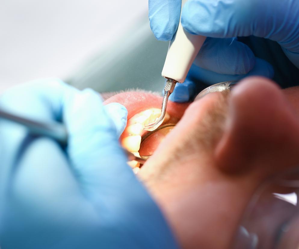  Dentysta przedawkował znieczulenie, pacjent nie przeżył zabiegu 