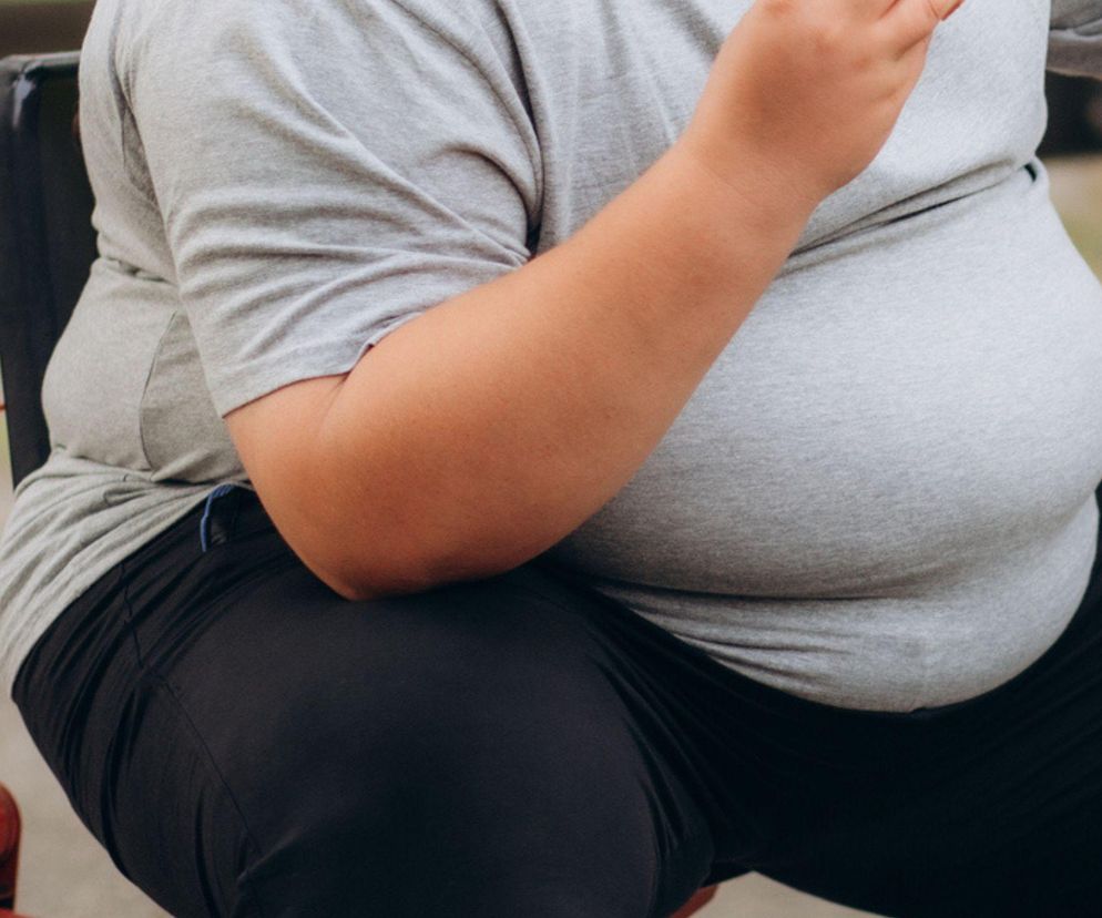 Leczenie otyłości tylko pod nadzorem lekarskim. Unikam pojęcia dieta
