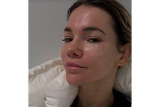 Maja Bohosiewicz w fatalnym stanie! Kontuzja żeber to dopiero początek kłopotów