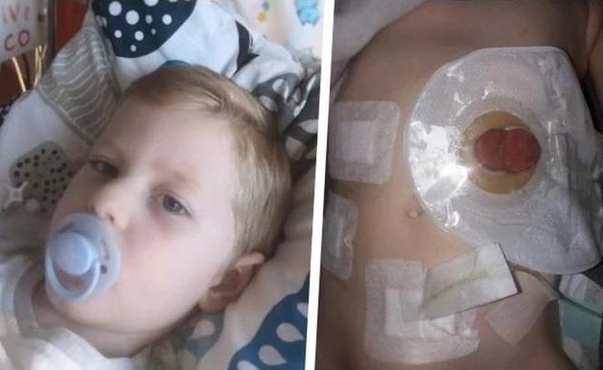 Mały Antoś chce mieć normalne dzieciństwo