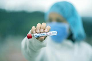 Kiedy lekarz zleca test na koronawirusa? Sprawdź NOWE wytyczne