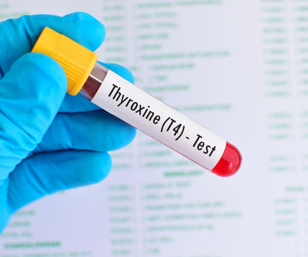 Tyroksyna (tetrajodotyronina, T4) jest jednym z hormonów produkowanych przez komórki pęcherzykowe tarczycy.