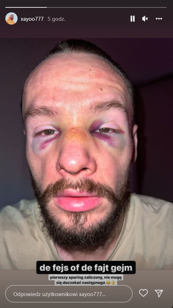 Marcin Xayoo Majkut przed walką na FAME MMA 14