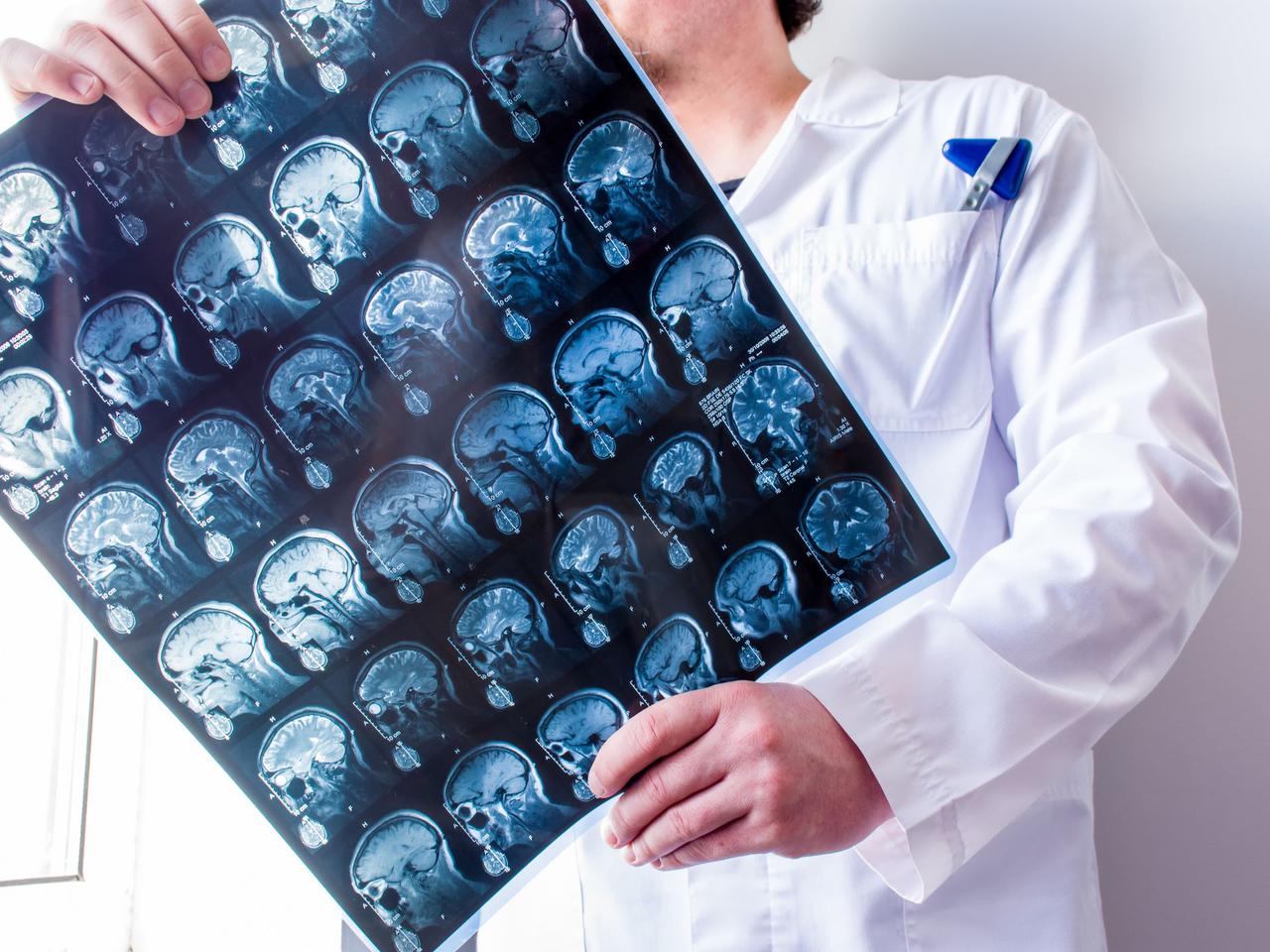 Encefalopatia cukrzycowa: przyczyny, objawy, leczenie