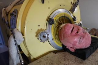W żelaznym respiratorze żyje ponad 70 lat. Straciłem wszystko