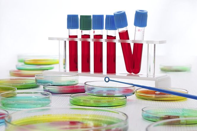 Badania biochemiczne krwi: LDH (LD), dehydrogenaza mleczanowa - normy