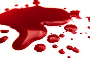 Gorączka krwotoczna: rodzaje, objawy, leczenie