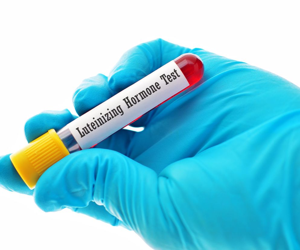 Hormon LH: lutropina, hormon luteinizujący