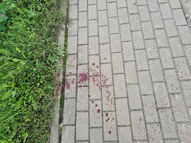 Leżajsk. Obciął dłoń maczetą [ZDJĘCIA]