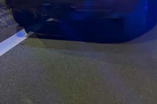 Uwielbiany muzyk uległ wypadkowi. Pokazał zdjęcia! Koncert odwołano