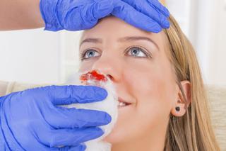 Krwawienie z nosa w ciąży: przyczyna i sposoby na krwawienie z nosa