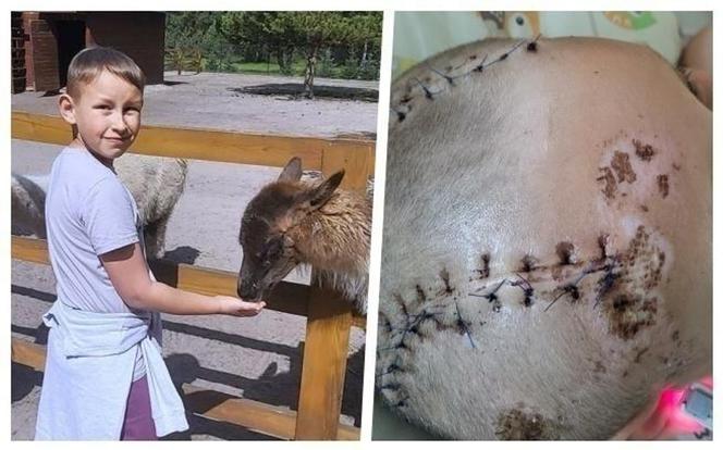„Mamo, Ignasia uderzył samochód”. Niedziela, która zmieniła wszystko. Przywróćmy uśmiech na twarzy małego wojownika