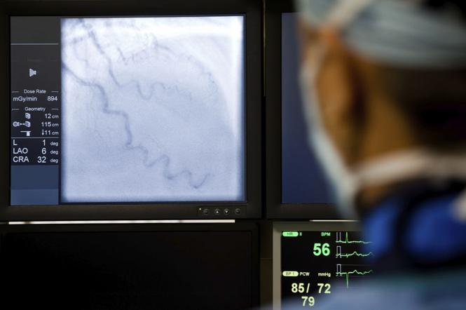 Angiografia nerkowa - badanie naczyniowe nerek