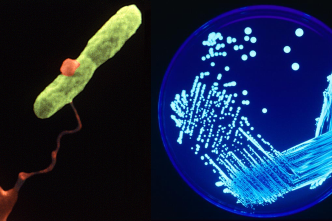 Legionella