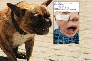 Pies pogryzł dziecko. Policja szuka właściciela