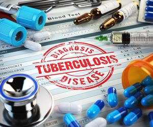 Próba tuberkulinowa - badanie diagnozujące gruźlicę