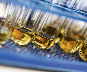 Urobilinogen w moczu  – co to jest, skąd się bierze, jakie ma znaczenie w diagnostyce
