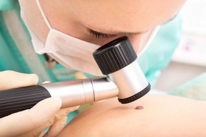 Jakie badania wykonuje dermatolog