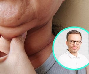 Jak się pozbyć drugiego podbródka? “Wystarczą 3 minuty dziennie”