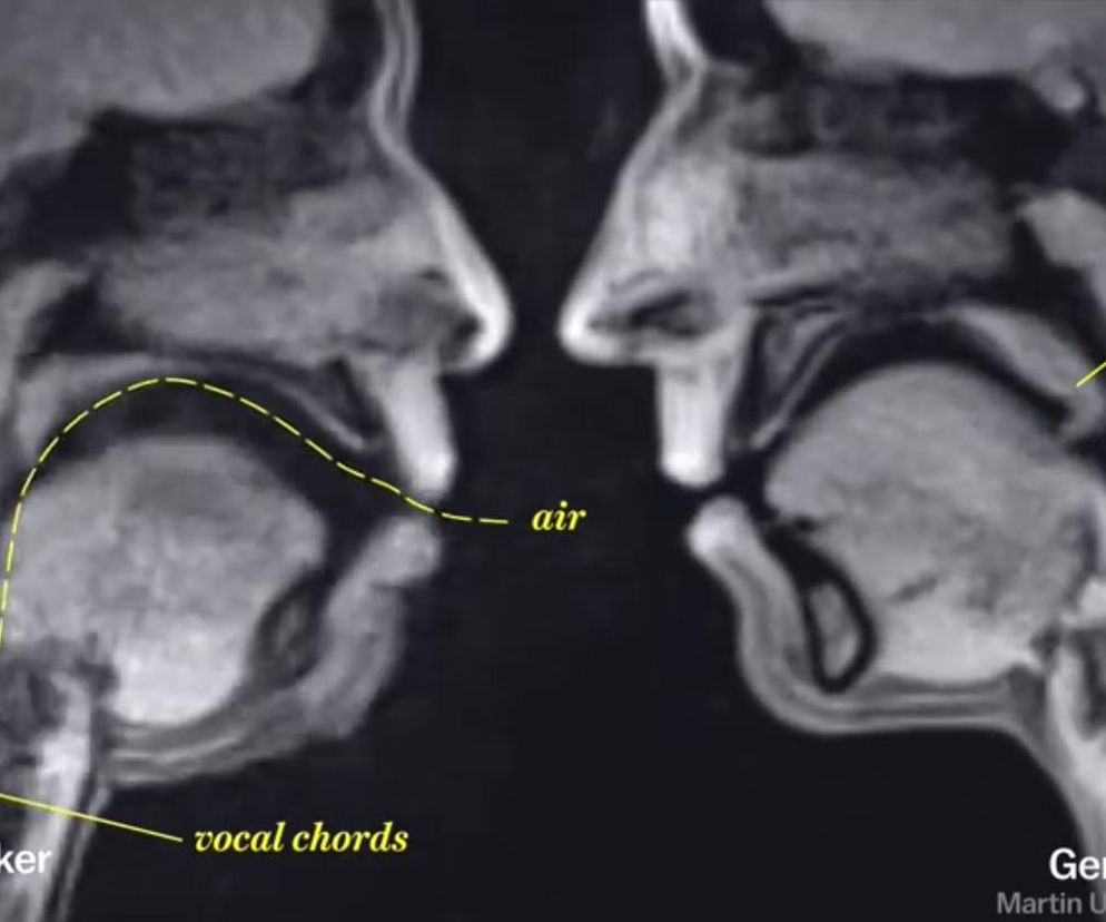 Tak wygląda człowiek OD ŚRODKA, kiedy uprawia SEKS! [NIESAMOWITE WIDEO]