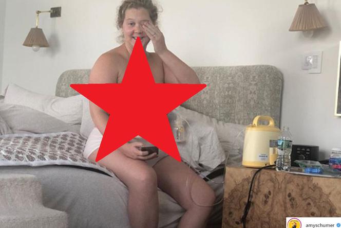 Amy Schumer