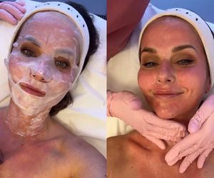 Ulubiony zabieg Pauliny Sykut-Jeżyny. Skóra w świetnej kondycji