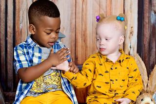 Urodziłam czarno-białe bliźniaki! Niezwykłe rodzeństwo 