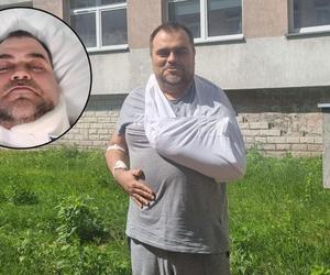 Potrącił znanego dziennikarza TVP, a potem uciekł! Krzysztof Czub walczy o zdrowie w szpitalu
