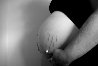 Rozstępów w ciąży można uniknąć - 6 sprawdzonych patentów czytelniczek na rozstępy