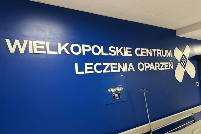 centrum oparzeń