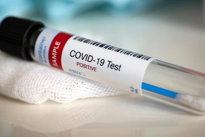 Nowe przypadki koronawirusa w regionie. Zakażone są nim cztery osoby      