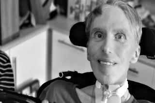 Nie żyje dr Peter Scott Morgan. Znany jako pierwszy cyborg w historii