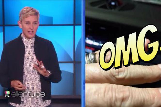 Ellen DeGeneres, zwichnięty palec
