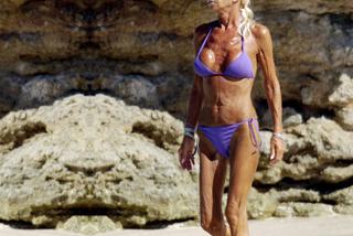 Donatella Versace, ofiary operacji plastycznych