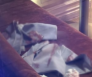 Atak nożownika w hotelu