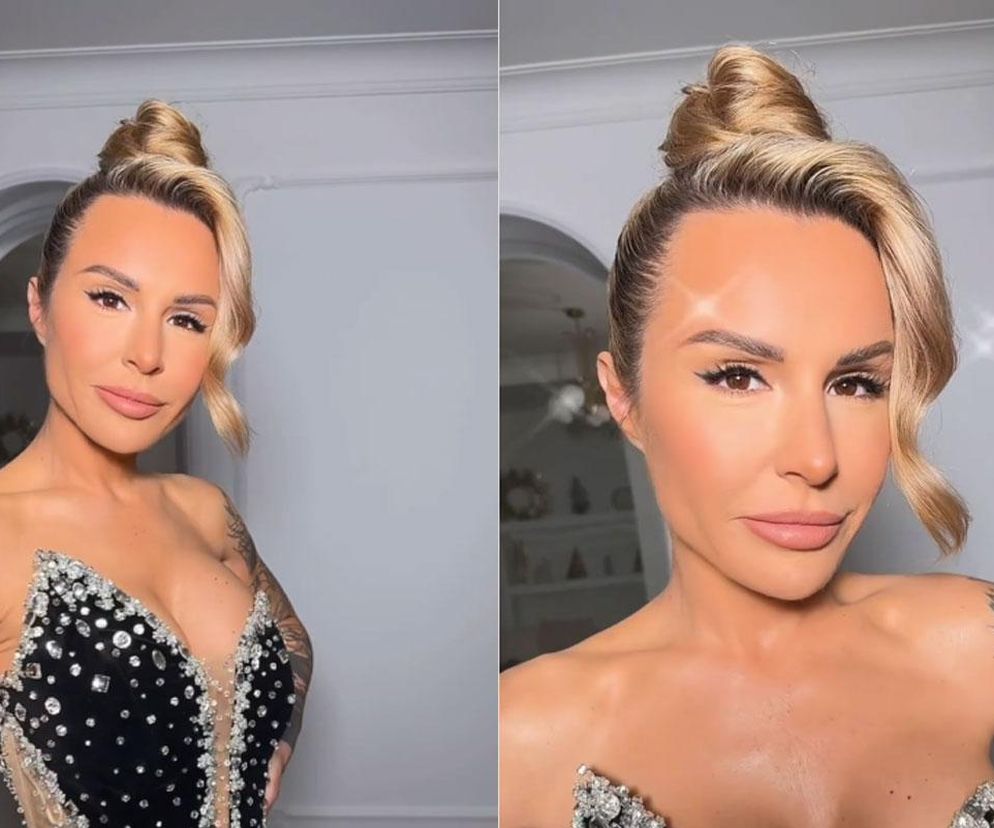 Blanka Lipińska niezadowolona z operacji. Myślałam, że będę wyglądać normalnie