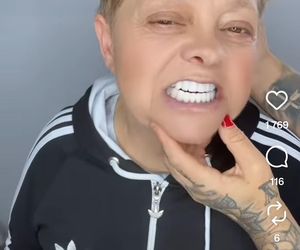 Laluna sprawiła mamie nowe zęby. Dałaś mi drugie życie